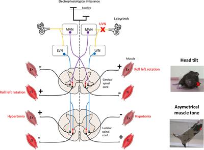 Quantitative Evaluation of a New Posturo-Locomotor Phenotype in a Rodent Model of Acute Unilateral Vestibulopathy